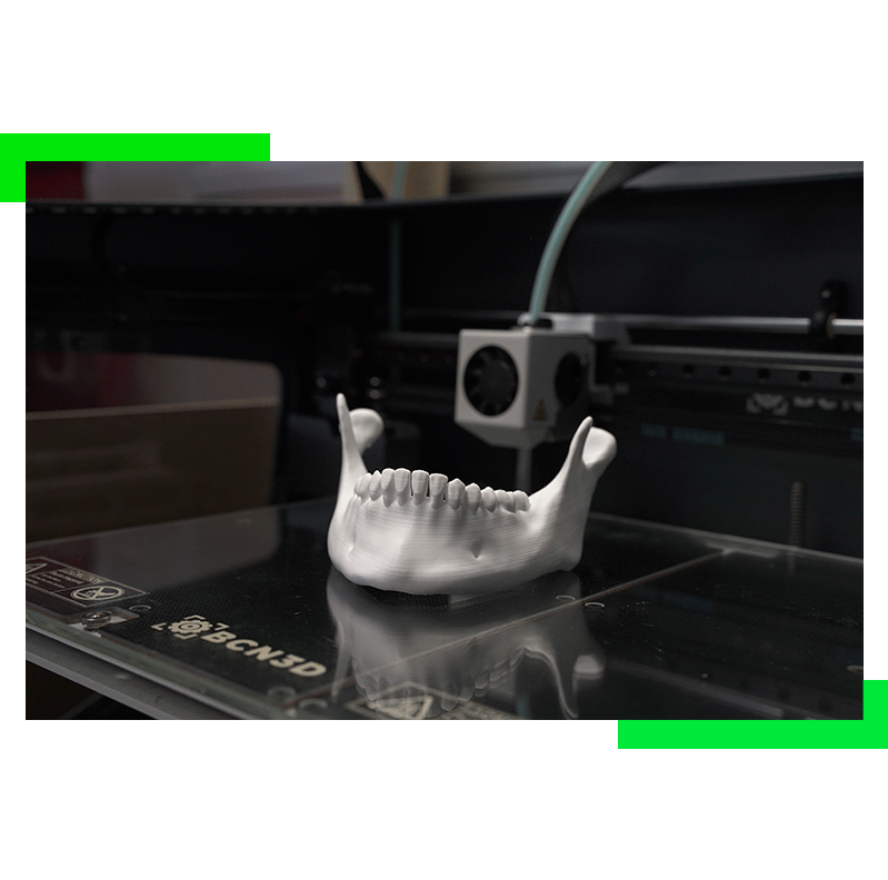 Prototipo médico de maxilar (calavera) fabricado en impresión 3D con bioplástico PLA-PRemium.